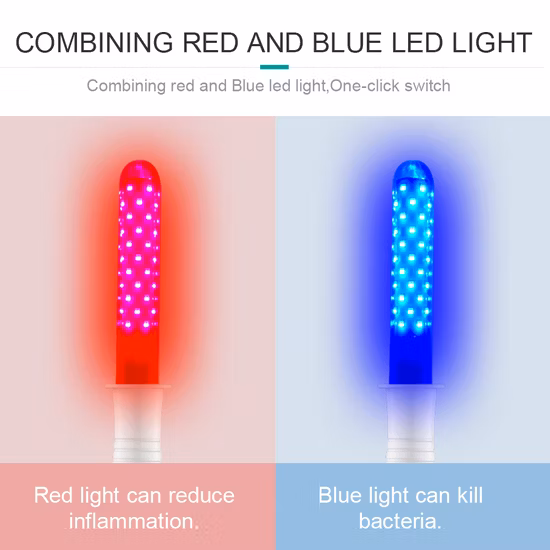 Instrumento terapéutico de enfermedades ginecológicas con ozono.